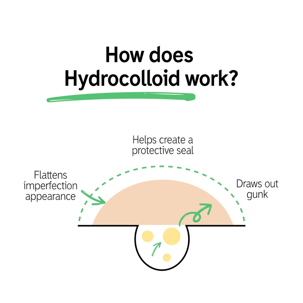405™ Hydrocolloid Roll