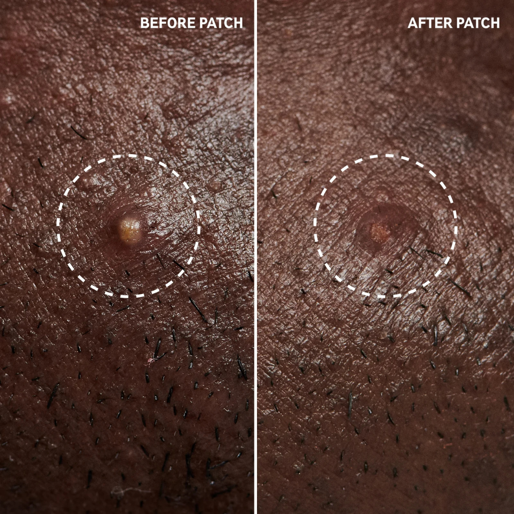 Before and after result 3